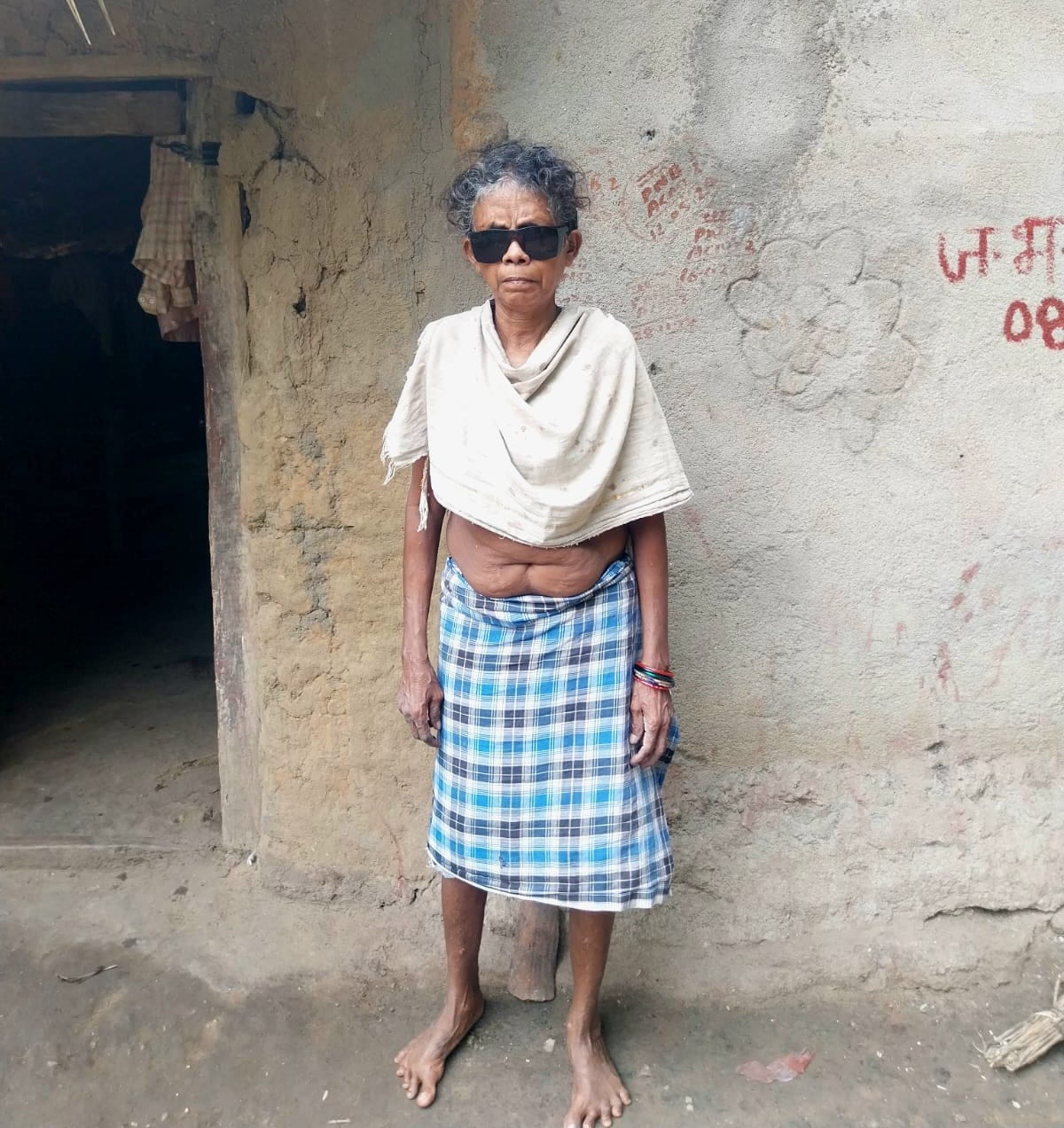 ‘मिशन दृष्टि’ का कमाल: ढाई साल बाद जब वंजाम जोगी ने देखा पति का चेहरा, छलक पड़े आंसू