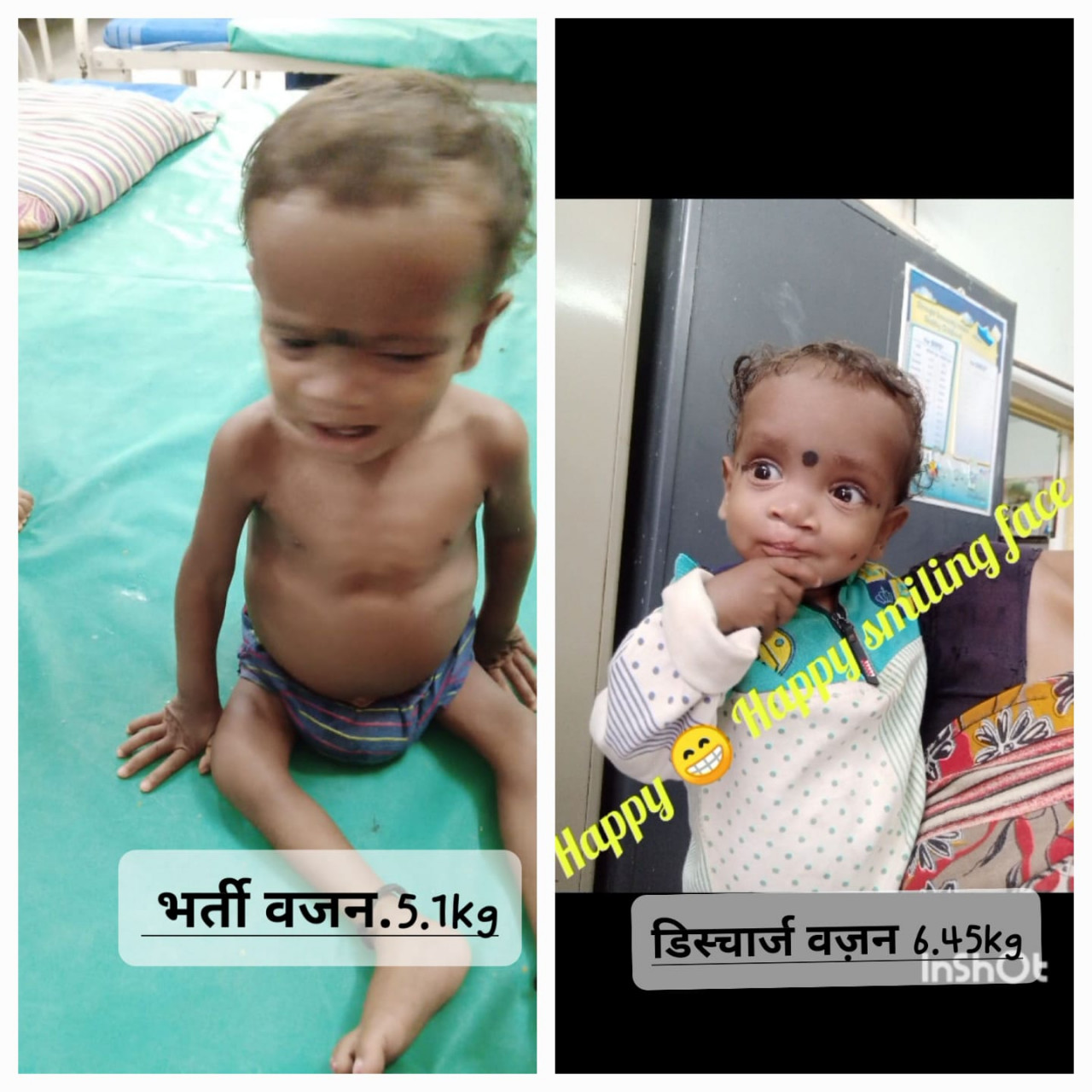पोषण पुनर्वास केंद्र ने ओमेश को कुपोषण से उबारा, अब स्वस्थ होकर लौटा घर